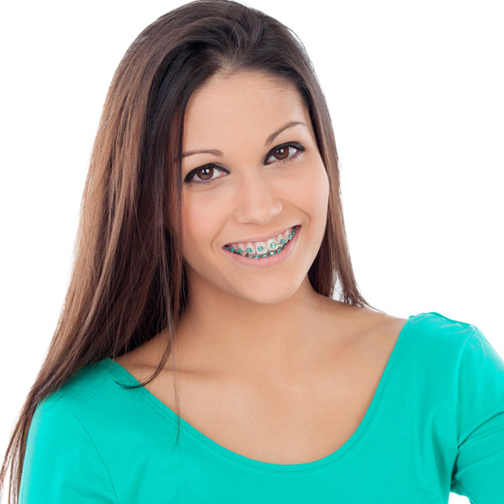 Fast Braces - Dental Services